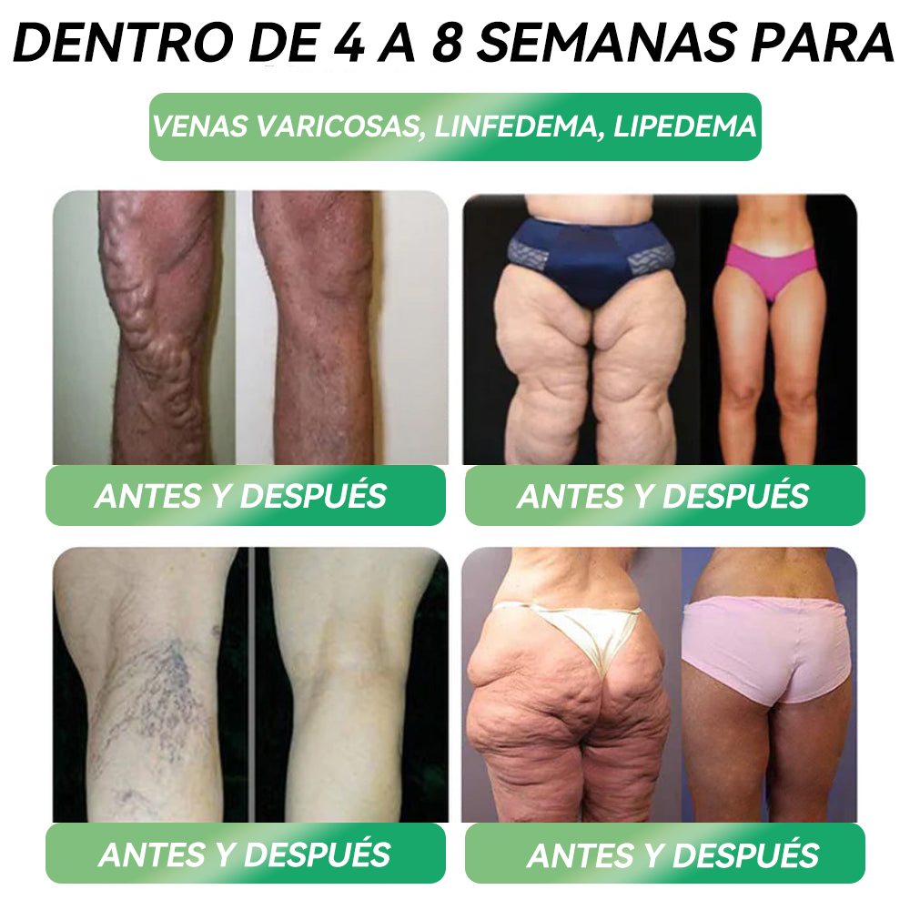 🌟¡Solo quedan 5 cajas! ¡Aprovecha ahora el 50% de descuento! ¡Recupera tu figura y salud! Si pierdes esta oportunidad ahora, ¡el próximo año podría ser demasiado tarde! 💥🔥